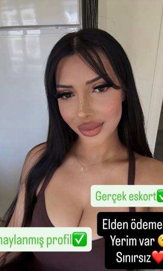 ARZU✅️